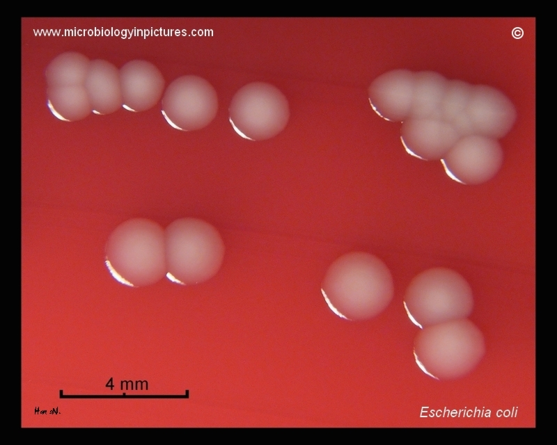 E.coli gamma-hemolysis